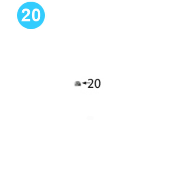 Backup Cam Ring Assembly 5/8